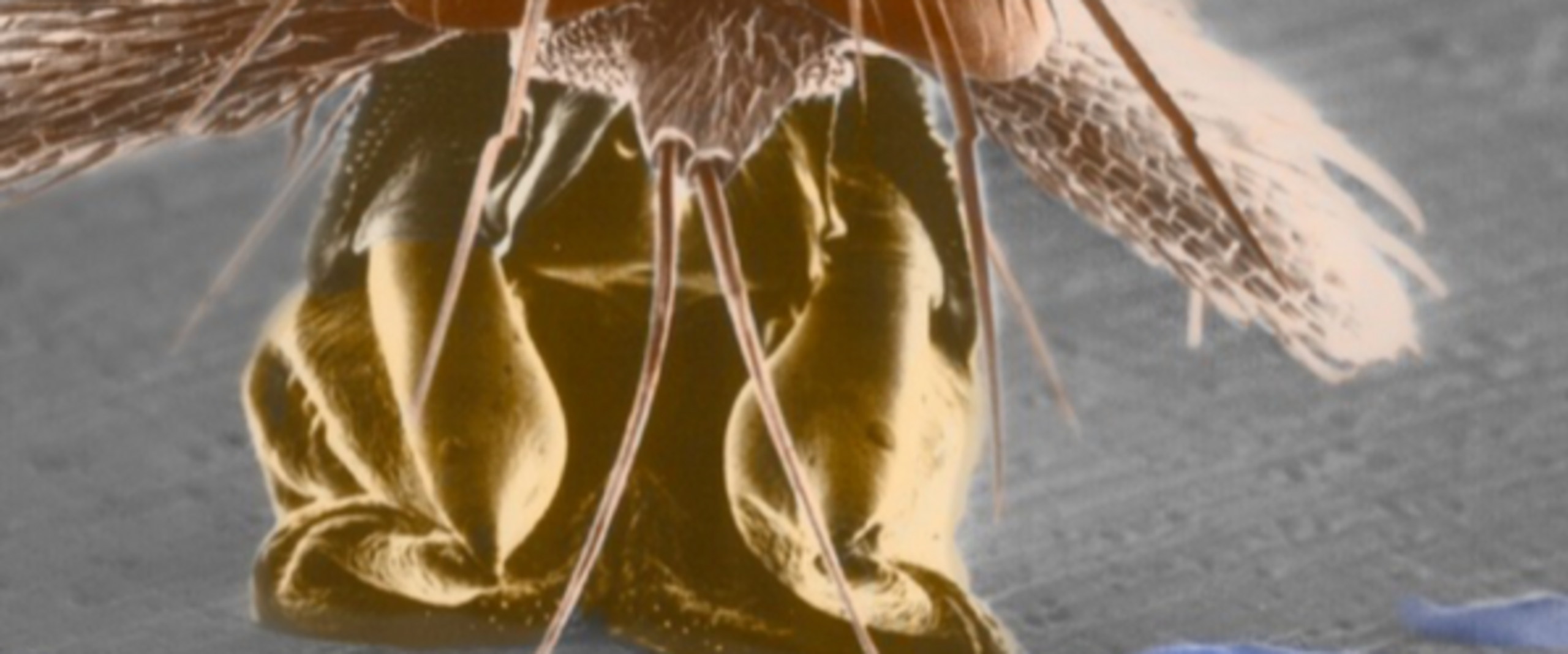 Mikroskopaufnahme eines Ameisenfu&szlig;es im Elektronenmikroskop.