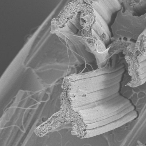 PM Müssig_Raster-Elektronenmikroskopie-Aufnahme  Schwarz-Weiß-Aufnahme