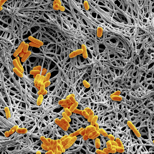 DFG Kalender Foto 2026 Schwarz-weiß-Aufnahme zeigt fadenähnliche Strukturen. Überall verteilt sieht man organgefarbene Elemente.