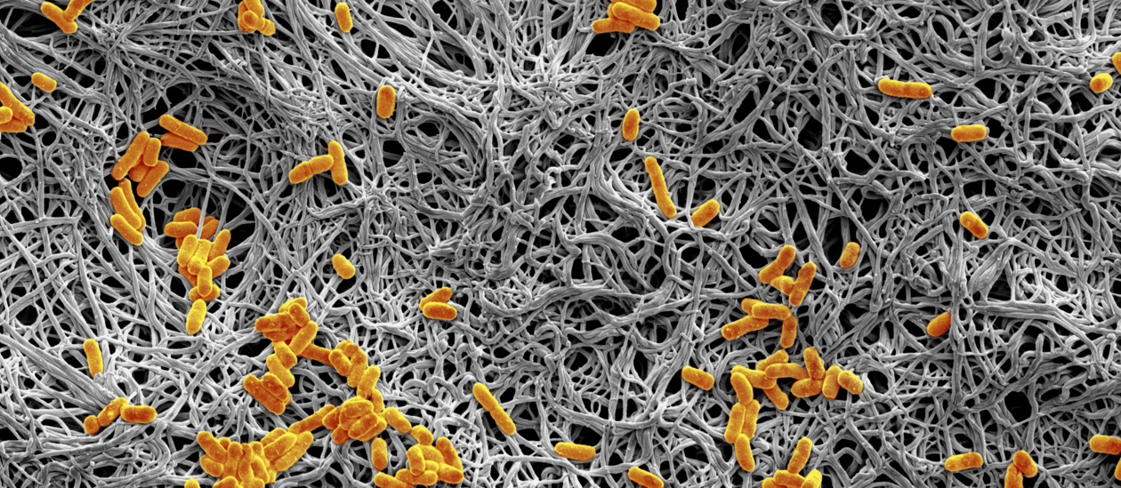 Schwarz-wei&szlig;-Aufnahme zeigt faden&auml;hnliche Strukturen. &Uuml;berall verteilt sieht man organgefarbene Elemente.