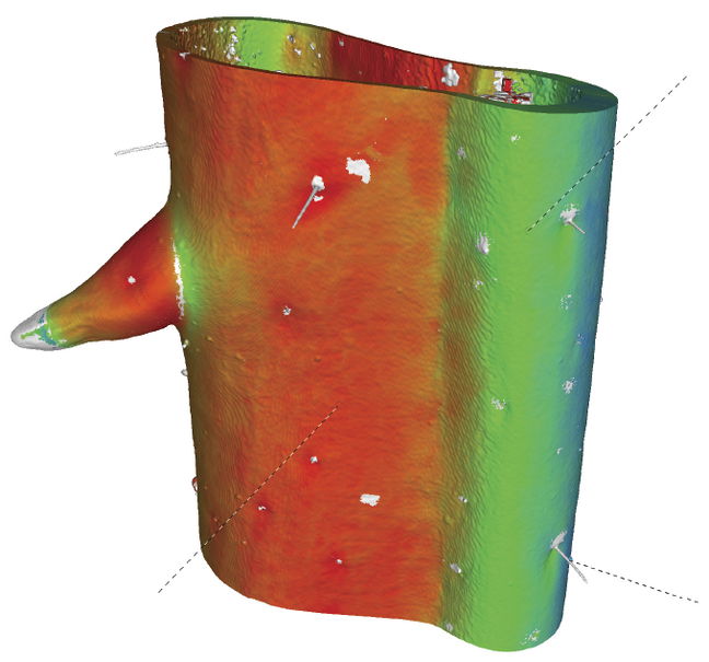  MicroCT of the tibia