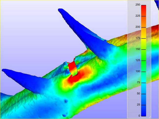 Tibial tearing analyzed using the FEM method
